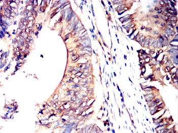 SGCG Antibody