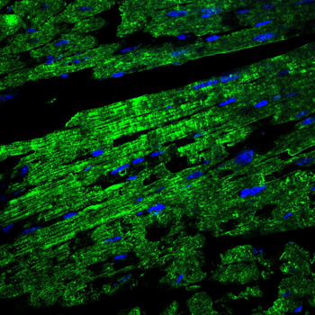 SGCG Antibody