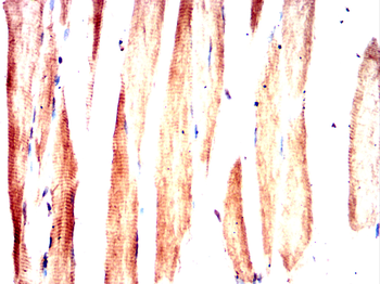 SGCG Antibody