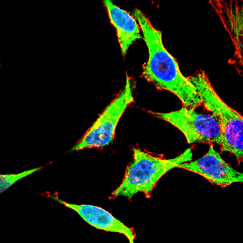 GCLM Antibody