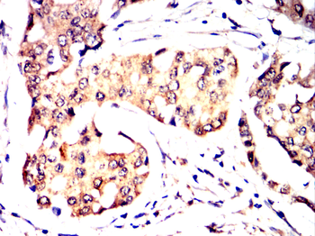 GCLM Antibody