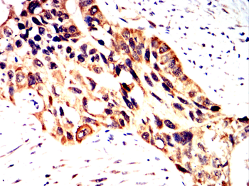 GCLM Antibody