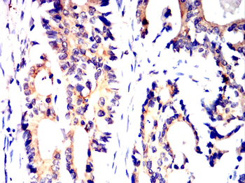 GCLM Antibody