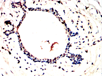PRKDC Antibody