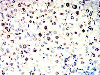PRKDC Antibody