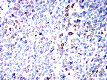 PRKDC Antibody