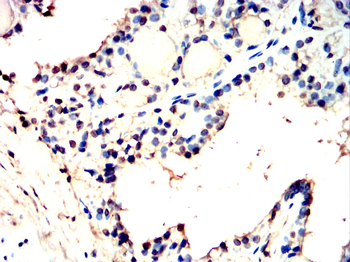 PRKDC Antibody