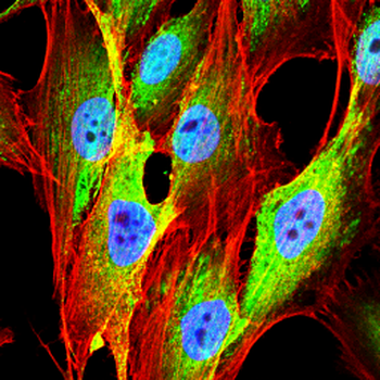 ME2 Antibody