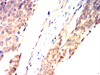 ME2 Antibody