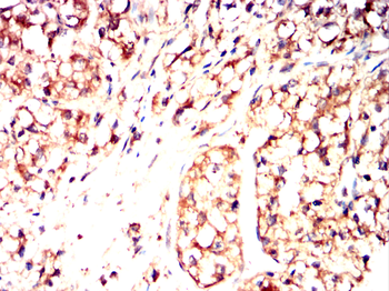 ME2 Antibody
