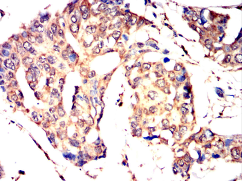 ME2 Antibody