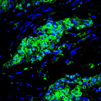 MKRN2 Antibody
