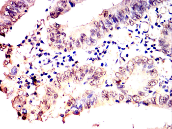 MKRN2 Antibody