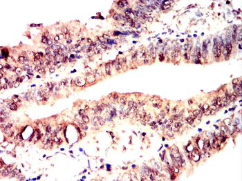 MKRN2 Antibody