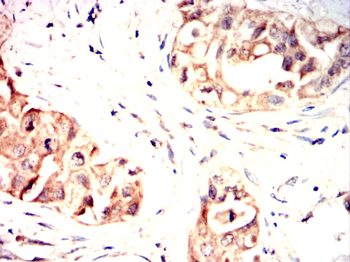 TERF2IP Antibody