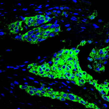 TERF2IP Antibody