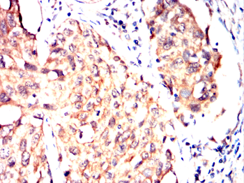TERF2IP Antibody
