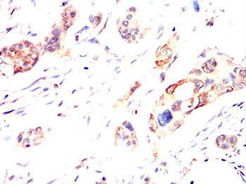 TERF2IP Antibody