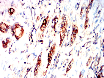 TERF2IP Antibody
