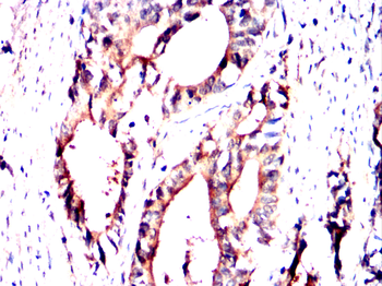 TERF2IP Antibody