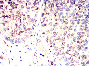 PLIN3 Antibody