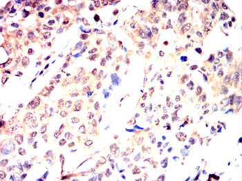RNF20 Antibody