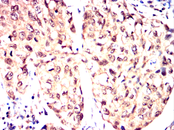 RNF20 Antibody