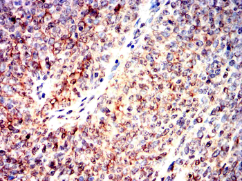 CREB3L4 Antibody