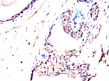 CREB3L4 Antibody