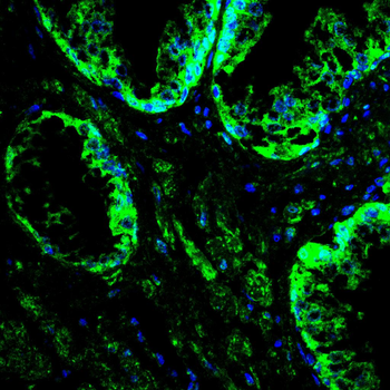 CREB3L4 Antibody