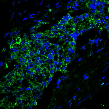 EEF1E1 Antibody