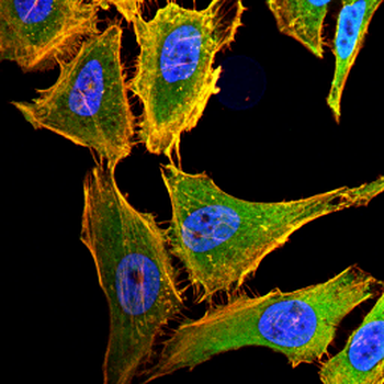 ACOX1 Antibody