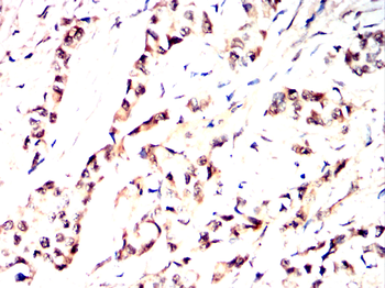 PFKP Antibody