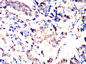PFKP Antibody