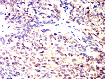 PFKP Antibody