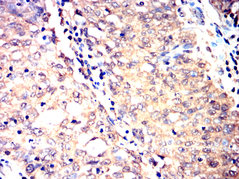 PFKP Antibody