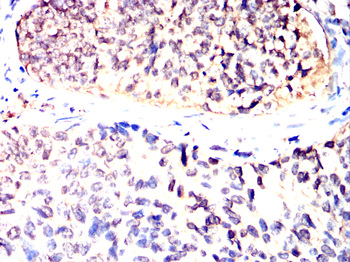 PFKP Antibody