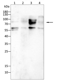 PFKP Antibody