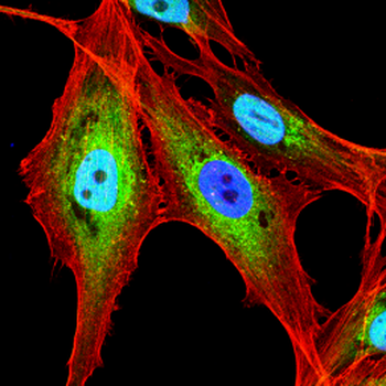 RAD23B Antibody