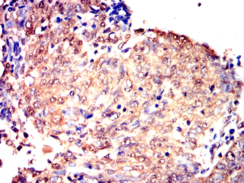 RAD23B Antibody