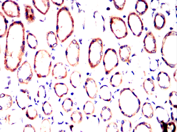 CYP26A1 Antibody