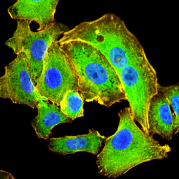 EI2BG Antibody