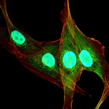 MBD2 Antibody