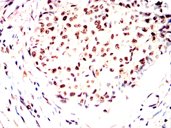 MBD2 Antibody