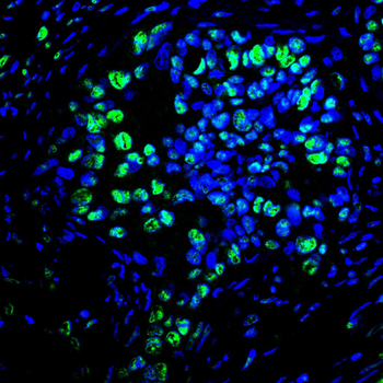 MBD2 Antibody