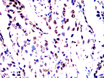 MBD2 Antibody