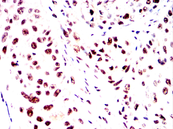 MBD2 Antibody