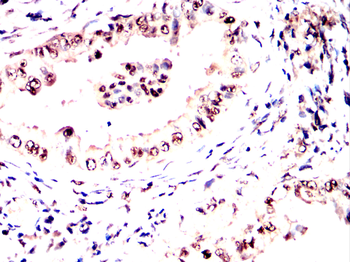 MBD2 Antibody