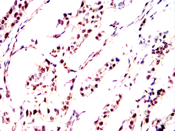 MBD2 Antibody