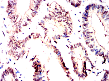 MBD2 Antibody